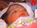 Du jamais vu, un enfant né avec six jambes au Pakistan